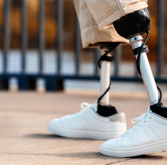 dopasowanie leja protezowego